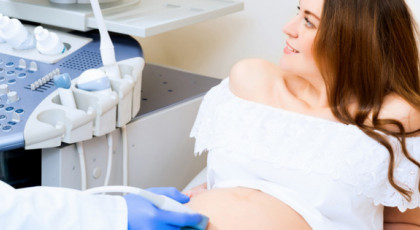 4D ultrazvuk trudnica između 22. i 28. nedelje!