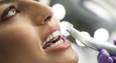 1190 din za ultrazvučno uklanjanje kamenca sa poliranjem zuba+kiretaža paradontalnih džepova (do 5 )+gratis stomatološki pregled-DR AST!