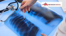  5200 din za pulmološki paket (pregled pulmologa+spirometrija+tumačenje donetog rendgena ili skenera) u ordinaciji Vračar Medical!