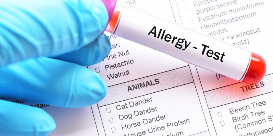 1490 din za alergološko ispitivanje na inhalacione alergene (polen, ambroziju, prašinu, g ...