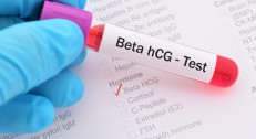 700 din za analizu hormona Beta-HCG u poliklinici Labomedica!