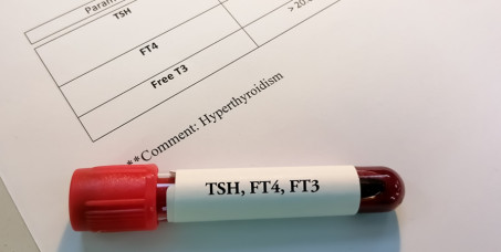 1550 din za analizu hormona štitaste žlezde (FT3,FT4,TSH) + laboratorija (KKS + glukoza, lipidni status, AST, ALT, urea, kreatinin, Fe) + tumačenje rezultata - Millenium Medic!