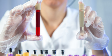 1200 din za osnovnu krvnu sliku,BH,URIN,UK+ab u klinici N&N Medicus u Mirijevu!