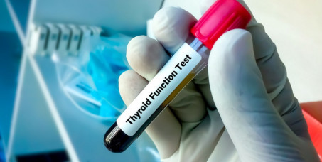 1600 din za analizu hormona štitne žlezde (FT3,FT4,TSH)-Laboratorija City Lab na Novom Beogradu!