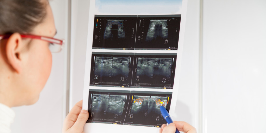 3990 din za UZ štitatste žlezde + UZ abdomena + analiza najvažnijih hormona štitaste žlezde (FT3,FT4,TSH) uz pojašnjenje laboratorijskih analiza -Millenium Medic!
