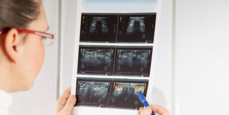 3990 din za UZ štitatste žlezde + UZ abdomena + analiza najvažnijih hormona štitaste žlezde (FT3,FT4,TSH) uz pojašnjenje laboratorijskih analiza -Millenium Medic!