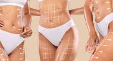 2000 din za Ultra Slim anticelulit paket u ordinaciji Leona life na Novom Beogradu!