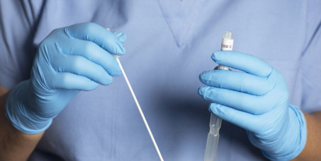 1400 din za paket briseva i analiza za dame ili muškarce (chlamydia, mycoplasma, ureaplasma, uratralni bris) u poliklinici Labomedica!