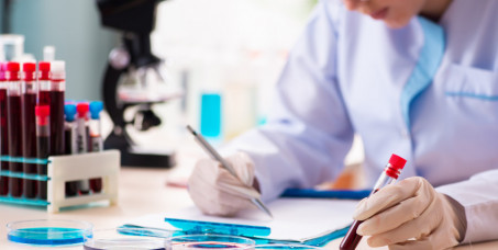 3900 din za biohemiju + štitna žlezda u poliklinici Labomedica!