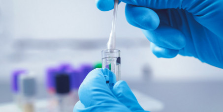 1490 din za paket briseva i analiza+tumačenje rezultata i terapija (bakterijska vaginoza,candida, gonokok+analiza najvažnijih hormona štitaste žlezde (T3,T4,TSH)-Labomedica!