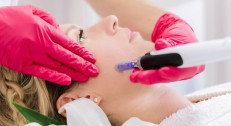 1990 din za dermapen tretman lica u salonu Exclusive beauty box u Žarkovu!