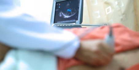 5000 din za ultrazvuk srca sa kolor doplerom, EKG zapis i ultrazvuk abdominalne aorte u ordinaciji Doutora!