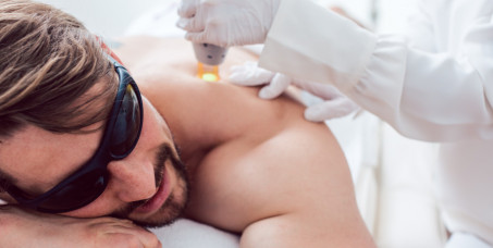 1290 din za lasersku epilaciju ramena za muškarce u salonu Krasiva na Novom Beogradu!