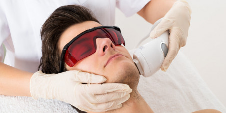 990 din za lasersku epilaciju lica za muškarce u salonu Krasiva na Novom Beogradu!