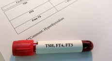 1300 din za analizu hormona štitne žlezde Free T(TSH,FT3,FT4) -Millenium Medic!