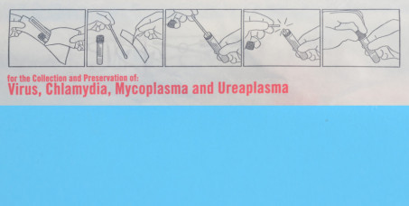 1900 din za STANDARD briseve za muškarce(uretralni bris sa 3 analize: Hlamidija, Mikoplazma, Ureaplazma)-Millenium Medic!