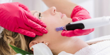 1990 din za dermapen tretman lica u salonu Exclusive beauty box u Žarkovu!