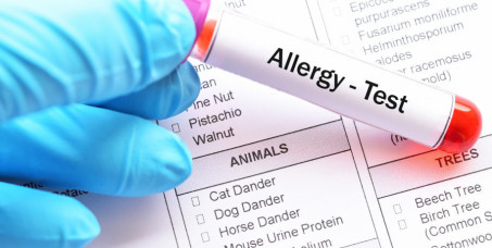 2500 din za alergološko ispitivanje na inhalacione alergene (polen, ambroziju, prašinu, grinje, perje)Vega Orl-Banovo Brdo!