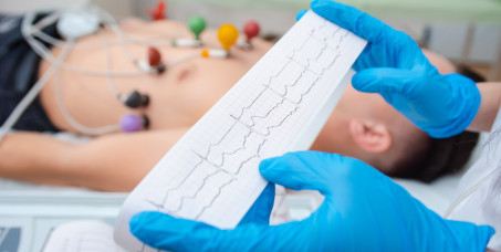 4500 din za 24h EKG sa zaključkom lekara u internističkoj ordinaciji SB MEDIC na SLAVIJI!