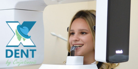 4200 din za digitalno 3D snimanje zuba u ordinaciji X DENT!