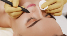 2500 din za uklanjanje do 10 virusnih bradavica u salonu Ashanti beauty na Voždovcu!