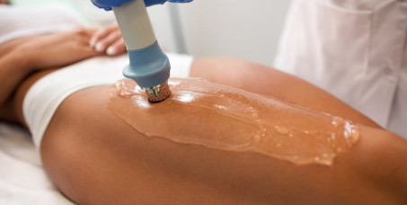 2000 din za shockwave anticelulit terapiju regije po izboru (20min) u Balance health centru na Slavujevom vencu!