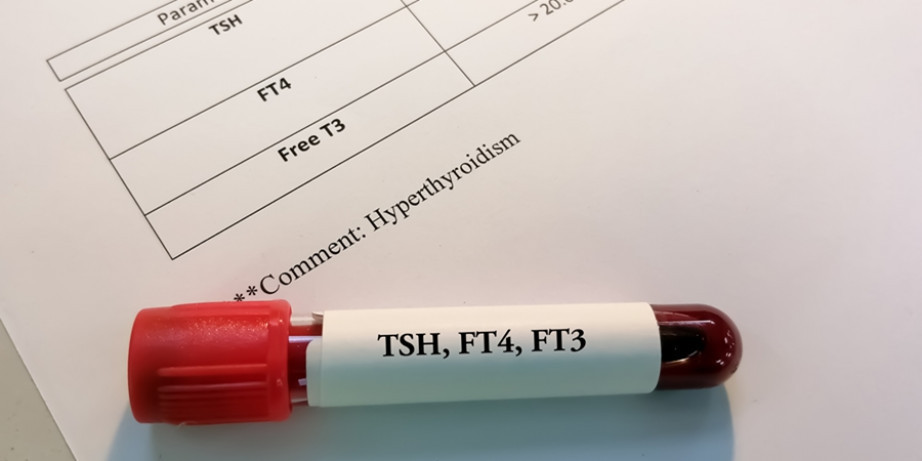 1300 din za analizu hormona štitne žlezde Free T(TSH,FT3,FT4) -Millenium Medic!