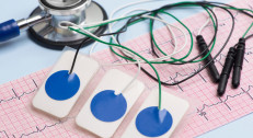 2500 din za 24h holter EKG-a bez očitavanja kardiologa u poliklinici Gracia Medika!