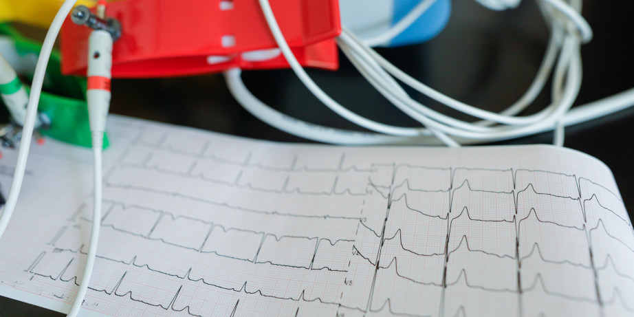 7000 din za Holter EKG i TA sa očitavanjem u poliklinici Gracia Medika!