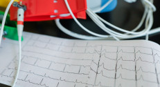 4200 din za holter EKG-a u HERZ MEDIKA na Vračaru!