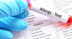 2500 din za alergološko ispitivanje na inhalacione alergene (polen, ambroziju, prašinu, grinje, perje)Vega Orl-Banovo Brdo!