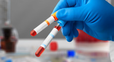 1400 din za biohemijsku analizu krvi (glukoza,kompletni lipidogram,urea,kreatinin,gvožđe,bilirubin,AST,ALT,GGT) u poliklinici Labomedica!