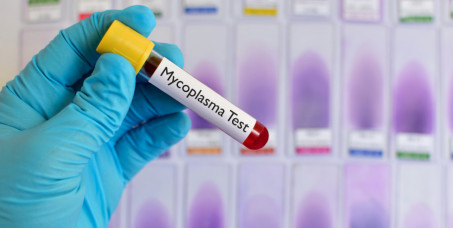 2700 din za briseve za muškarce (hlamidija,mikoplazma,ureplazma) u klinici N&N Medicus u Mirijevu!