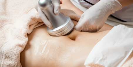 5000 din za paket od 5 kavitacija po 30 minuta u salonu MAGIC BOKA na Zvezdari!