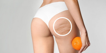 3500 din za limfnu drenažu (45 minuta) u Body Balance & Physio centru!