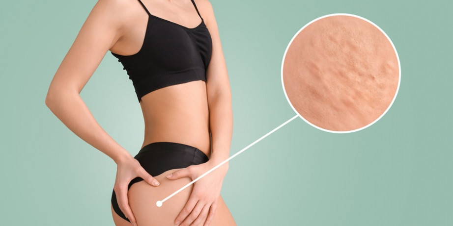1200 din za Vacuum fit anticelulit tretman (30min) u PHYSIO SENSE centru!