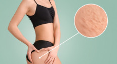 1200 din za Vacuum fit anticelulit tretman (30min) u PHYSIO SENSE centru!