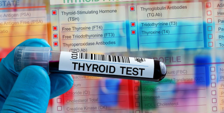 3562 din za analizu hormona i antitela štitne žlezde (fT4, fT3, TSH, anti-TPO, anti-TG) u Zavodu za biocide i medicinsku ekologiju na Banovom brdu!