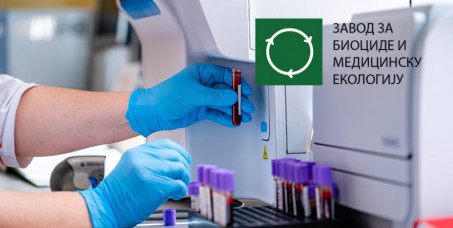 15400 din za test intolerancije na hranu: određivanje IgG antitela (216 namirnica) u Zavodu za biocide i medicinsku ekologiju na Banovom brdu!