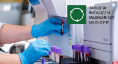 15400 din za test intolerancije na hranu: određivanje IgG antitela (216 namirnica) u Zavodu za biocide i medicinsku ekologiju na Banovom brdu!
