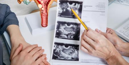 7500 din za EXTRA ginekološki paket: ginekološki pregled,ultrazvuk,PAPA,kolposkopija,3 brisa (Hlamidija, Mikoplazma, Ureaplazma) u poliklinici Labomedica!