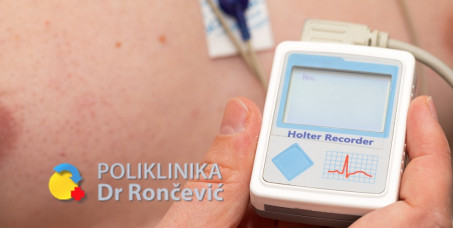 3500 din za holter EKG 24 sata sa izveštajem lekara u poliklinici Dr Rončević!
