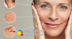 5000 din za tretman CO2 frakcionisanim laserom za uklanjanje bora u poliklinici Dr Rončević!