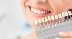 6000 din za ordinacijsko beljenje zuba sa White smile gelom (3*nanošenje po 15 min)+gratis ultrazvučno uklanjanje kamenca i poliranje zuba-Duo Estetica-kod Beogradske Arene!