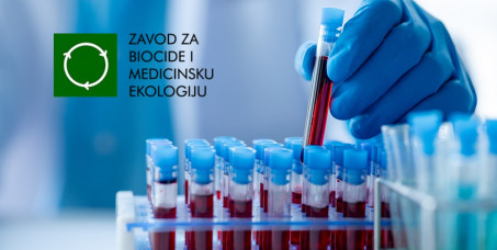 7900 din za hormonski panel za žene:TSH,FT3,FT4,Prolaktin,Estradiol,Progesteron,LH,FSH,Testosteron,Kortizol,Insulin + Glukoza (HOMA indeks) u Zavodu za biocide i medicinsku ekologiju na Banovom brdu!