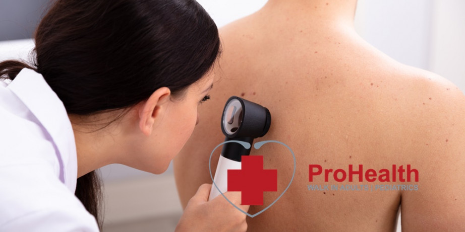 3500 din za pregled lekara docenta dermatologije, pregled dermoskopom (kontrola mladeža)  ...