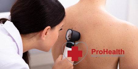 3500 din za pregled lekara docenta dermatologije, pregled dermoskopom (kontrola mladeža) u ProHealth klinici u centru grada!