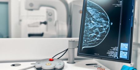 6800 din za mamografski pregled i ultrzvuk dojki u Zavodu Gaj!