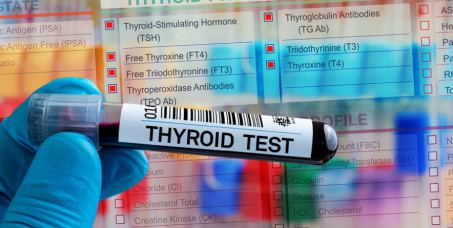 3562 din za analizu hormona i antitela štitne žlezde (fT4, fT3, TSH, anti-TPO, anti-TG) u Zavodu za biocide i medicinsku ekologiju na Banovom brdu!