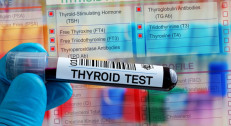 3562 din za analizu hormona i antitela štitne žlezde (fT4, fT3, TSH, anti-TPO, anti-TG) u Zavodu za biocide i medicinsku ekologiju na Banovom brdu!